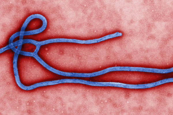 Microscopic image of Ebola.