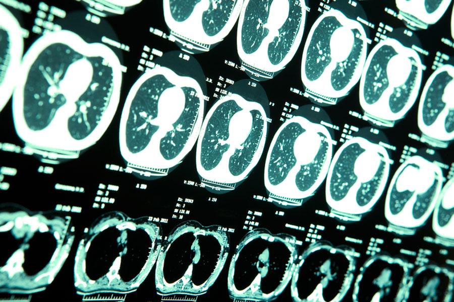 A magnetic resonance imaging machine, or MRI, is typically used to diagnose concussions. X-rays like the ones seen above reveal whether or not a concussion was sustained.